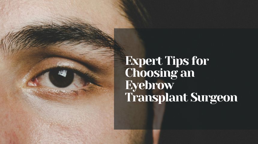 Expert Tips for Choosing an Eyebrow Transplant Surgeon