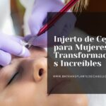 Injerto de Cejas para Mujeres: Transformaciones Increíbles