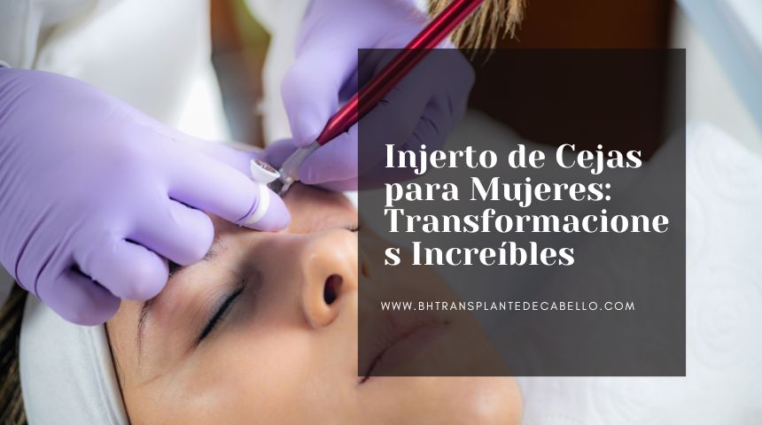 Injerto de Cejas para Mujeres: Transformaciones Increíbles