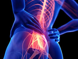 How Does Neuropathic Pain Impact Daily Life?
