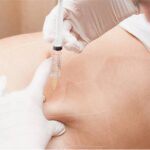 Fat Dissolving Injection: A Modern Solution for Body Contouring and Fat Reduction 