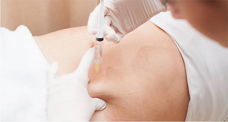 Fat Dissolving Injection: A Modern Solution for Body Contouring and Fat Reduction 