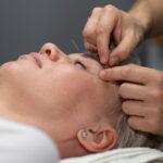 face lifting treatment west island