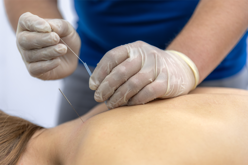 How Auricular Acupuncture Works: Benefits of Ear Acupuncture Therapy for Wellness and Skin Care