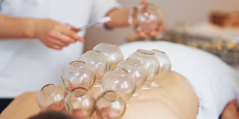 How Cupping Therapy in NYC Supports Respiratory Comfort